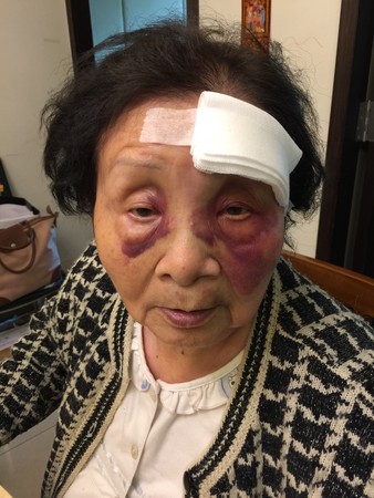 包含老妇人球员因伤缺席下一场比赛的词条